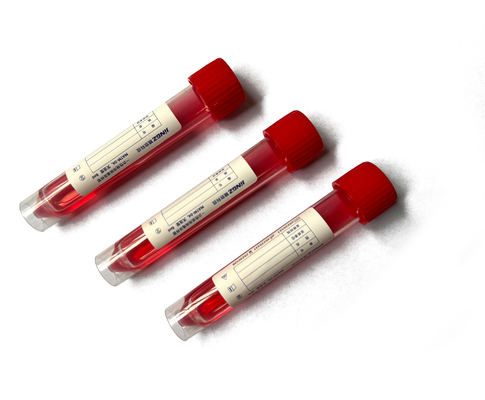 Covid-19 바이러스 샘플링은 5ml-10ml 견본 수집 관 집단 면봉을 장비를 답니다