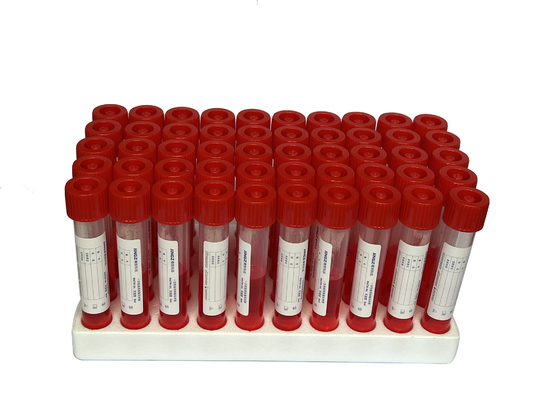 Covid-19 바이러스 샘플링은 5ml-10ml 견본 수집 관 집단 면봉을 장비를 답니다