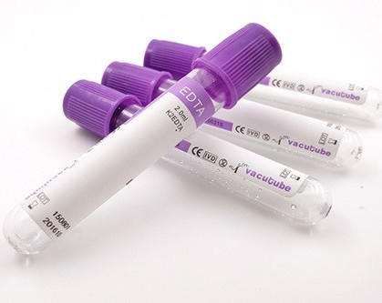 높이에 따른 혈액 검사 진공을 위한 JINGZ 0.5ml-10ml K2 EDTA 튜브