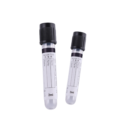 병원을 위한 2ml-4ml 진공 구연산나트륨 채혈 튜브