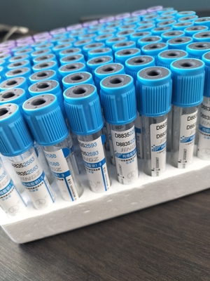 의료 맞춤형 PET 유리 검사 나트륨 시트라트 3.2% PT 튜브 2-10ml 진공 혈액 수집 튜브